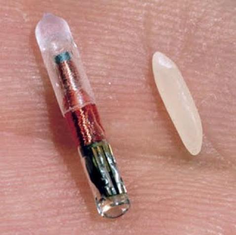 Puce sous-cutanée en France : implant électronique & corporel